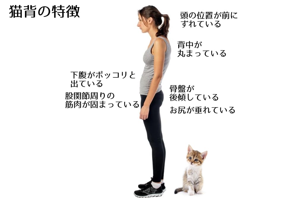 猫背の特徴1